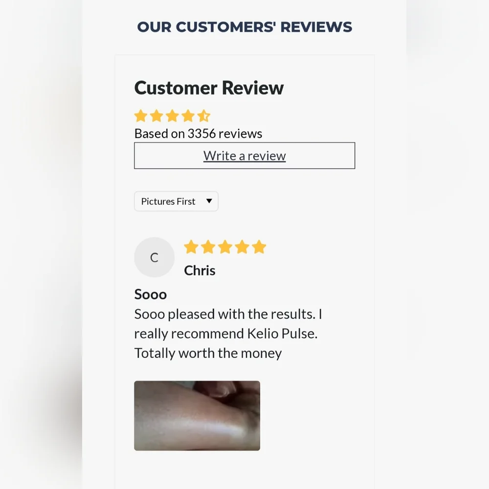 Kelio Pulse Hair Removal Handset (IPL)